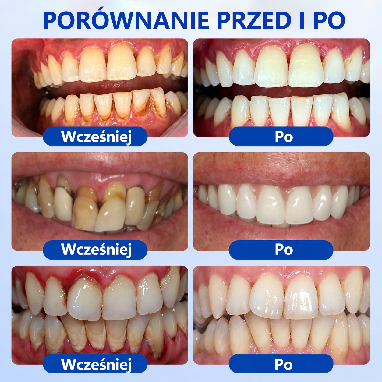 🦷🦷 𝑮𝒍𝒊𝒎𝒎𝒆𝒓𝒍𝒚® 𝑮𝒖𝒎𝑹𝒆𝒗𝒊𝒗𝒆 𝒁̇𝒆𝒍 𝒅𝒐 𝑹𝒆𝒈𝒆𝒏𝒆𝒓𝒂𝒄𝒋𝒊 𝑫𝒛𝒊𝒂̨𝒔𝒆ł
