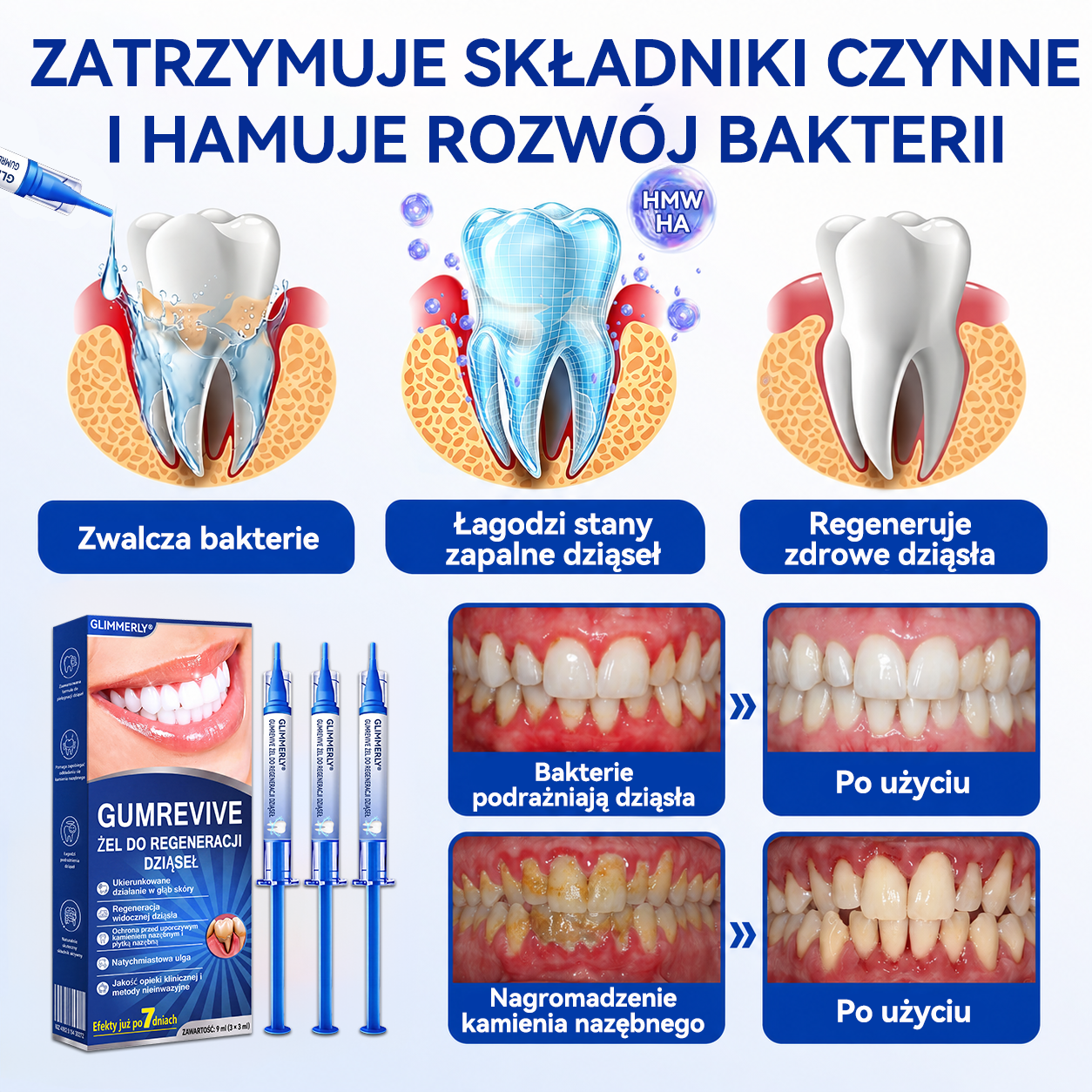 🦷🦷 𝑮𝒍𝒊𝒎𝒎𝒆𝒓𝒍𝒚® 𝑮𝒖𝒎𝑹𝒆𝒗𝒊𝒗𝒆 𝒁̇𝒆𝒍 𝒅𝒐 𝑹𝒆𝒈𝒆𝒏𝒆𝒓𝒂𝒄𝒋𝒊 𝑫𝒛𝒊𝒂̨𝒔𝒆ł