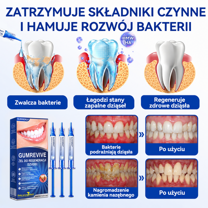 🦷🦷 𝑮𝒍𝒊𝒎𝒎𝒆𝒓𝒍𝒚® 𝑮𝒖𝒎𝑹𝒆𝒗𝒊𝒗𝒆 𝒁̇𝒆𝒍 𝒅𝒐 𝑹𝒆𝒈𝒆𝒏𝒆𝒓𝒂𝒄𝒋𝒊 𝑫𝒛𝒊𝒂̨𝒔𝒆ł
