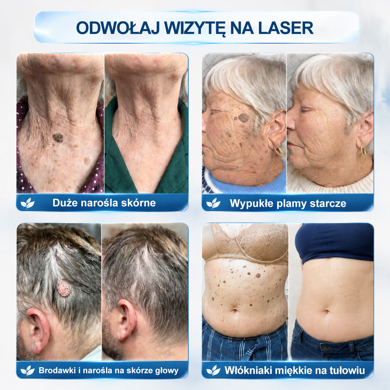𝐏i𝐜𝐝o®❤️❤️ 7 𝑫𝒏𝒊 𝑷𝒓𝒆𝒑𝒂𝒓𝒂𝒕 𝑫𝒐 𝑼𝒔𝒖𝒘𝒂𝒏𝒊𝒂 𝑾łó𝒌𝒏𝒊𝒂𝒌ó𝒘 𝑴𝒊ę𝒌𝒌𝒊𝒄𝒉 𝑰 𝑷𝒓𝒛𝒆𝒃𝒂𝒓𝒘𝒊𝒆ń(𝐁𝐞𝐳 𝐁ó𝐥𝐮, 𝐁𝐞𝐳 𝐁𝐥𝐢𝐳𝐧 – 𝐑𝐨𝐥𝐥-𝐨𝐧)