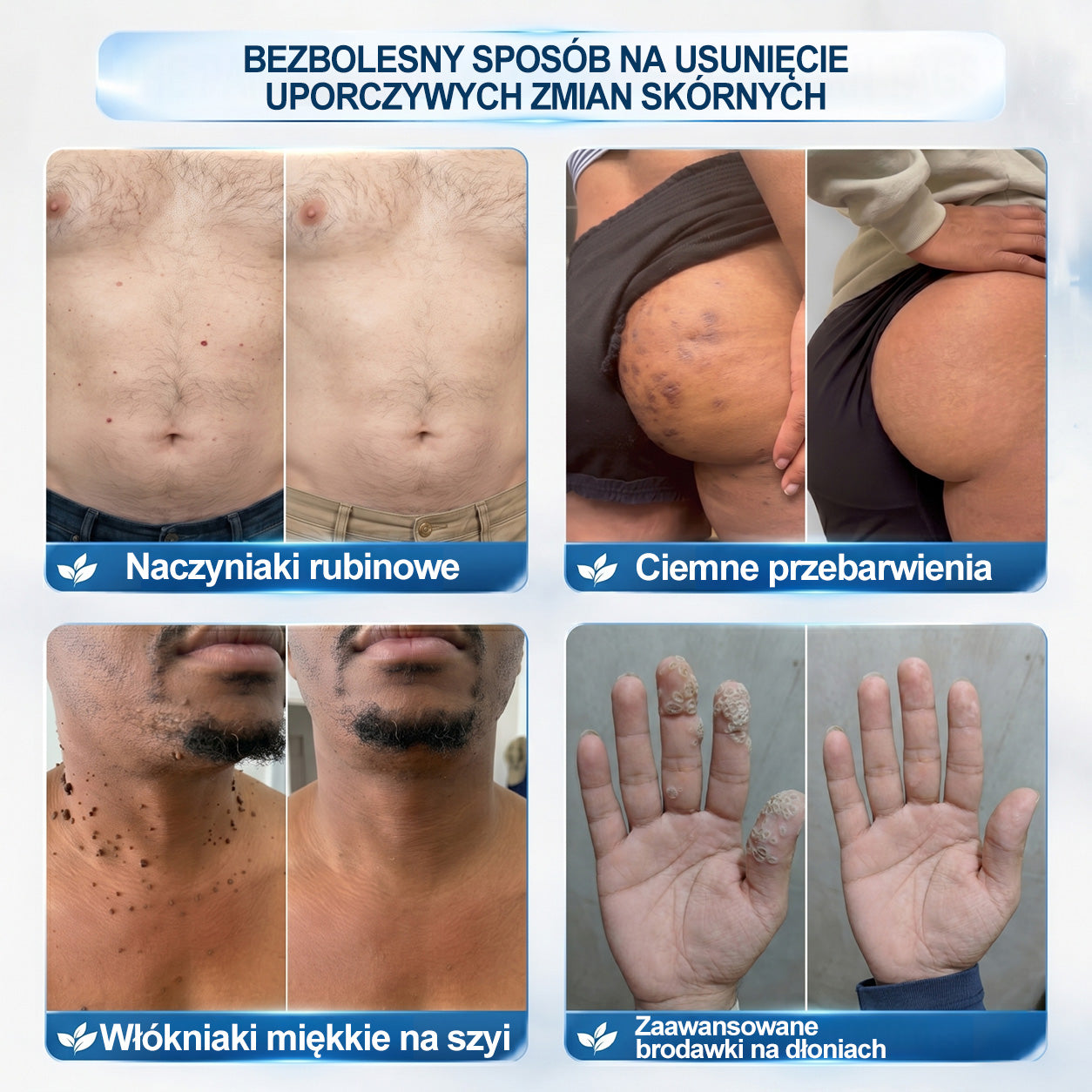 𝐏i𝐜𝐝o®❤️❤️ 7 𝑫𝒏𝒊 𝑷𝒓𝒆𝒑𝒂𝒓𝒂𝒕 𝑫𝒐 𝑼𝒔𝒖𝒘𝒂𝒏𝒊𝒂 𝑾łó𝒌𝒏𝒊𝒂𝒌ó𝒘 𝑴𝒊ę𝒌𝒌𝒊𝒄𝒉 𝑰 𝑷𝒓𝒛𝒆𝒃𝒂𝒓𝒘𝒊𝒆ń(𝐁𝐞𝐳 𝐁ó𝐥𝐮, 𝐁𝐞𝐳 𝐁𝐥𝐢𝐳𝐧 – 𝐑𝐨𝐥𝐥-𝐨𝐧)