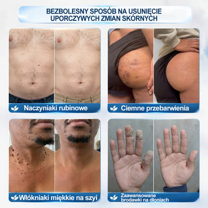 𝐏i𝐜𝐝o®❤️❤️ 7 𝑫𝒏𝒊 𝑷𝒓𝒆𝒑𝒂𝒓𝒂𝒕 𝑫𝒐 𝑼𝒔𝒖𝒘𝒂𝒏𝒊𝒂 𝑾łó𝒌𝒏𝒊𝒂𝒌ó𝒘 𝑴𝒊ę𝒌𝒌𝒊𝒄𝒉 𝑰 𝑷𝒓𝒛𝒆𝒃𝒂𝒓𝒘𝒊𝒆ń(𝐁𝐞𝐳 𝐁ó𝐥𝐮, 𝐁𝐞𝐳 𝐁𝐥𝐢𝐳𝐧 – 𝐑𝐨𝐥𝐥-𝐨𝐧)