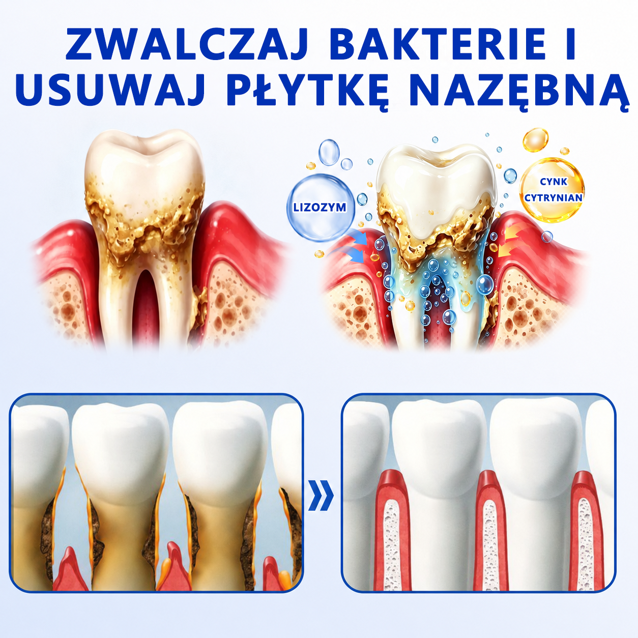 🦷🦷 𝑮𝒍𝒊𝒎𝒎𝒆𝒓𝒍𝒚® 𝑮𝒖𝒎𝑹𝒆𝒗𝒊𝒗𝒆 𝒁̇𝒆𝒍 𝒅𝒐 𝑹𝒆𝒈𝒆𝒏𝒆𝒓𝒂𝒄𝒋𝒊 𝑫𝒛𝒊𝒂̨𝒔𝒆ł