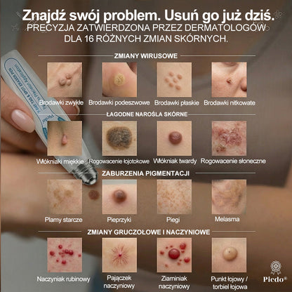 𝐏i𝐜𝐝o®❤️❤️ 7 𝑫𝒏𝒊 𝑷𝒓𝒆𝒑𝒂𝒓𝒂𝒕 𝑫𝒐 𝑼𝒔𝒖𝒘𝒂𝒏𝒊𝒂 𝑾łó𝒌𝒏𝒊𝒂𝒌ó𝒘 𝑴𝒊ę𝒌𝒌𝒊𝒄𝒉 𝑰 𝑷𝒓𝒛𝒆𝒃𝒂𝒓𝒘𝒊𝒆ń(𝐁𝐞𝐳 𝐁ó𝐥𝐮, 𝐁𝐞𝐳 𝐁𝐥𝐢𝐳𝐧 – 𝐑𝐨𝐥𝐥-𝐨𝐧)